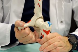 מבנה מפרק הירך