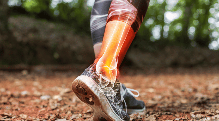 פציעות ספורט בכף רגל